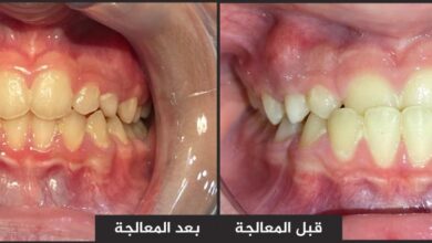 صورة تقويم الأسنان في العيادات التعليمية/ جامعة الكفيل